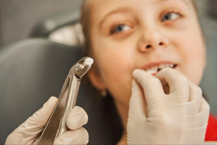 歯並びが二列だと抜歯が必要？二重歯列の矯正費用や保険適用の有無について