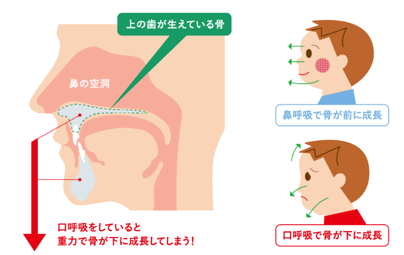 口呼吸による7つのデメリットに要注意！歯並びにも悪影響があるって本当？ | 横須賀市の歯医者｜はる小児歯科・矯正歯科クリニック