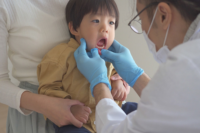 乳歯に穴があるのは虫歯？知らないと怖いリスクや治療法について