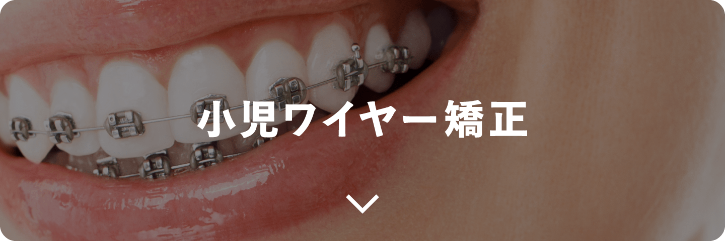 小児ワイヤー矯正