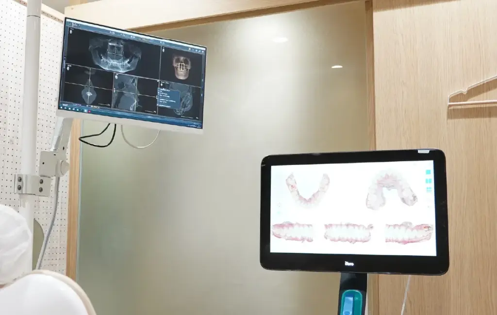歯列のシミュレーションソフトを表示するモニター